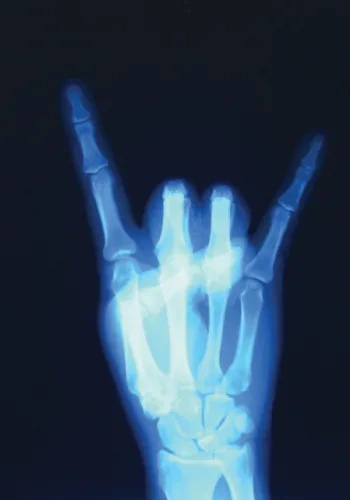 horns xray