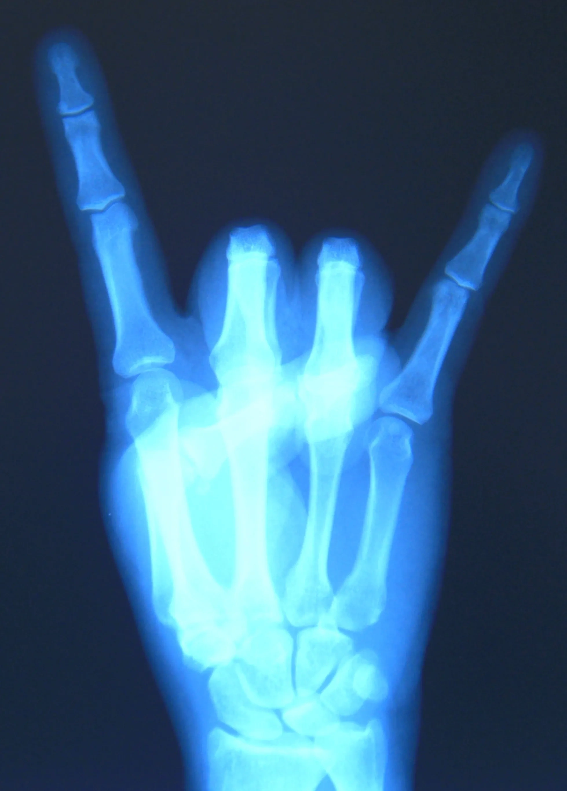 XRay