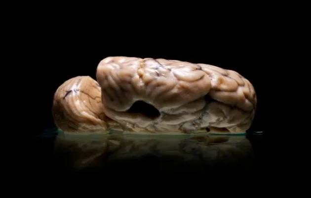 BrainsStudy-331