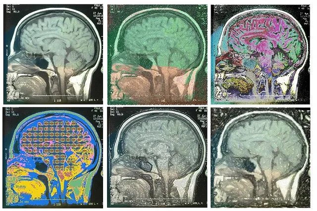 Research on the Brain