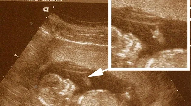 Future Longhorn Hooks 'Em - In the Womb